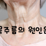 목주름 원인