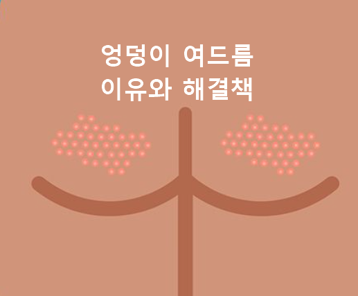 엉덩이 여드름 이유와 해결책