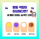 발톱 색상이상