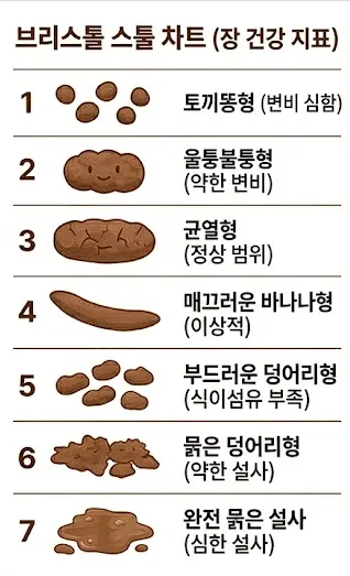 브리스톨스툴차트