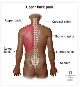 Upper back pai