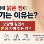 몸에 붉은 점이 생기는 이유?