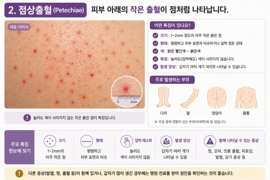 점상출혈