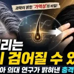 흰머리 원복