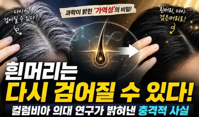 흰머리 원복